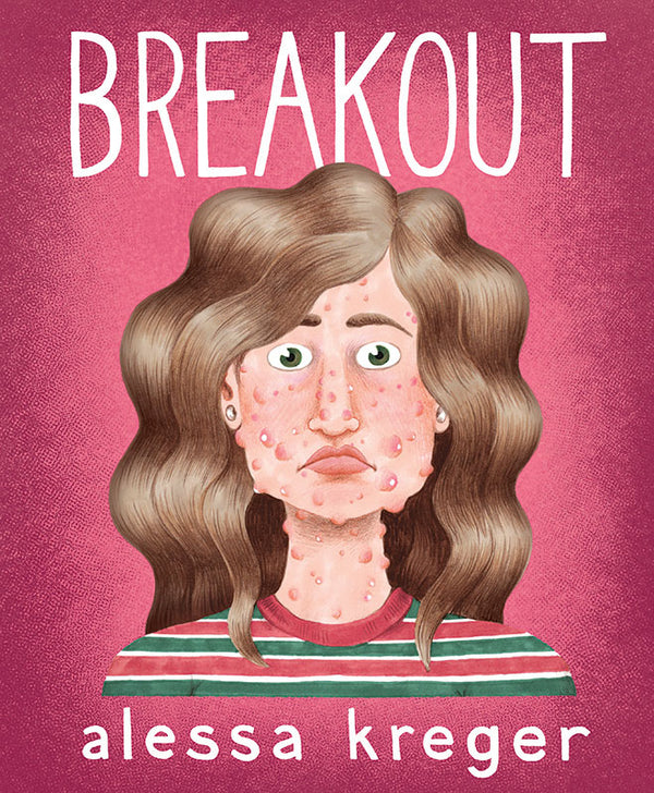 Breakout